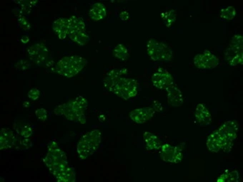 Anti-Hexokinase II antibody [4C5] used in Immunocytochemistry/ Immunofluorescence (ICC/IF). GTX84357