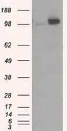 Anti-Hexokinase II antibody [4C5] used in Western Blot (WB). GTX84357