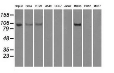 Anti-Hexokinase II antibody [4C5] used in Western Blot (WB). GTX84357