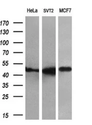 Anti-FKBP5 antibody [3E9] used in Western Blot (WB). GTX84491