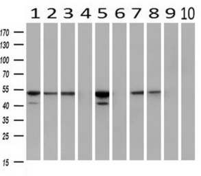 Anti-FKBP5 antibody [3E9] used in Western Blot (WB). GTX84491