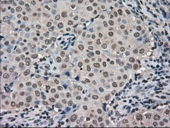 Anti-Mig-2 antibody [9E4] used in IHC (Paraffin sections) (IHC-P). GTX84507