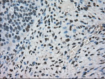 Anti-Mig-2 antibody [9E4] used in IHC (Paraffin sections) (IHC-P). GTX84507