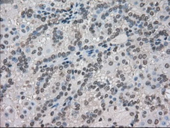 Anti-Mig-2 antibody [9E4] used in IHC (Paraffin sections) (IHC-P). GTX84507