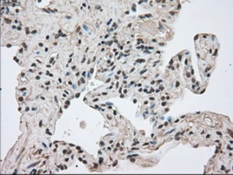 Anti-Mig-2 antibody [9E4] used in IHC (Paraffin sections) (IHC-P). GTX84507