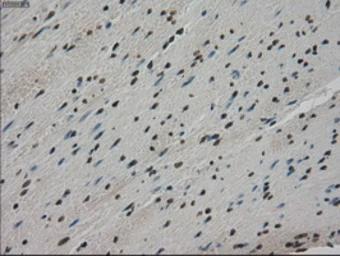 Anti-Mig-2 antibody [9E4] used in IHC (Paraffin sections) (IHC-P). GTX84507