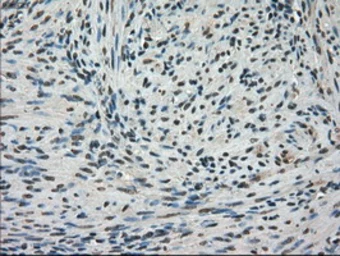 Anti-Mig-2 antibody [9E4] used in IHC (Paraffin sections) (IHC-P). GTX84507