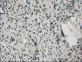 Anti-Mig-2 antibody [9E4] used in IHC (Paraffin sections) (IHC-P). GTX84507