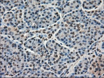Anti-Mig-2 antibody [9E4] used in IHC (Paraffin sections) (IHC-P). GTX84507