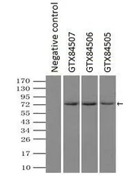 Anti-Mig-2 antibody [9E4] used in Immunoprecipitation (IP). GTX84507