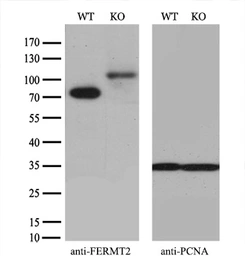 Anti-Mig-2 antibody [9E4] used in Western Blot (WB). GTX84507
