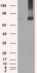 Anti-Mig-2 antibody [9E4] used in Western Blot (WB). GTX84507