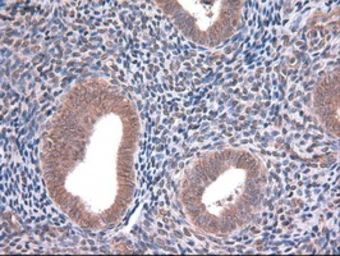 Anti-EpCAM antibody [2C8] used in IHC (Paraffin sections) (IHC-P). GTX84572