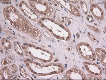 Anti-EpCAM antibody [2C8] used in IHC (Paraffin sections) (IHC-P). GTX84572