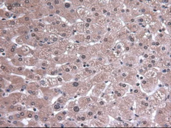 Anti-EpCAM antibody [2C8] used in IHC (Paraffin sections) (IHC-P). GTX84572