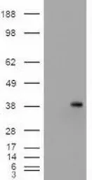 Anti-EpCAM antibody [2C8] used in Western Blot (WB). GTX84572