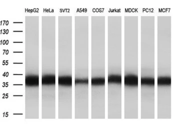 Anti-eIF2 alpha antibody [1H1] used in Western Blot (WB). GTX84582