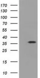 Anti-eIF2 alpha antibody [1H1] used in Western Blot (WB). GTX84582