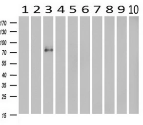 Anti-CDH13 antibody [3H6] used in Western Blot (WB). GTX84697