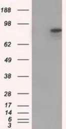 Anti-CDH13 antibody [3H6] used in Western Blot (WB). GTX84697