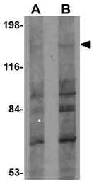 Anti-FRMPD1 antibody used in Western Blot (WB). GTX85011