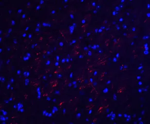 Anti-Occludin antibody used in IHC (Paraffin sections) (IHC-P). GTX85016