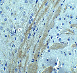 Anti-Occludin antibody used in IHC (Paraffin sections) (IHC-P). GTX85016