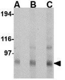 Anti-KA1 antibody used in Western Blot (WB). GTX85044