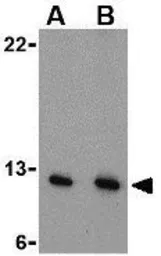Anti-PEN2 antibody used in Western Blot (WB). GTX85063