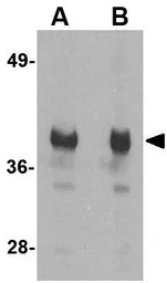 Anti-GAPDH antibody used in Western Blot (WB). GTX85118