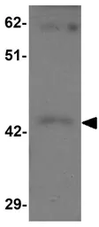 Anti-SHISA9 antibody used in Western Blot (WB). GTX85137