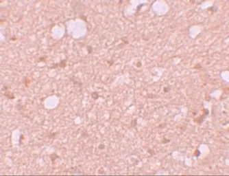 Anti-SESTD1 antibody used in IHC (Paraffin sections) (IHC-P). GTX85164