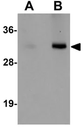 Anti-VENTX antibody used in Western Blot (WB). GTX85168