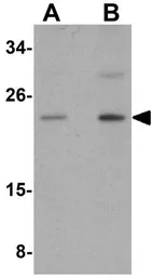 Anti-CaBP7 antibody used in Western Blot (WB). GTX85169