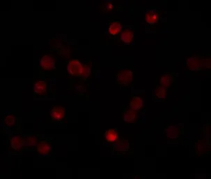 Anti-CaBP7 antibody used in Immunocytochemistry/ Immunofluorescence (ICC/IF). GTX85169