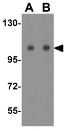 Anti-TMEM16B antibody used in Western Blot (WB). GTX85241