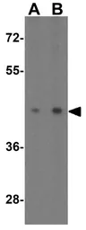 Anti-Spred3 antibody used in Western Blot (WB). GTX85375
