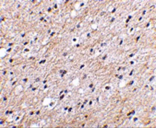 Anti-NIPSNAP antibody used in IHC (Paraffin sections) (IHC-P). GTX85406