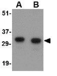 Anti-NIPSNAP antibody used in Western Blot (WB). GTX85406