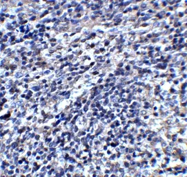 Anti-ORAI3 antibody used in IHC (Paraffin sections) (IHC-P). GTX85442