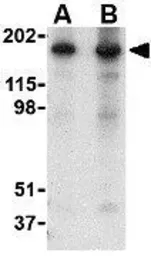 Anti-Nogo A antibody used in Western Blot (WB). GTX85448