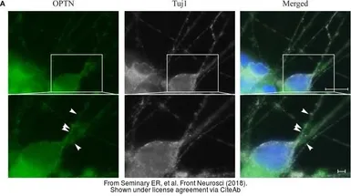 Anti-beta Tubulin 3/ Tuj1 antibody used in Immunocytochemistry/ Immunofluorescence (ICC/IF). GTX85469