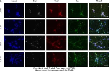 Anti-beta Tubulin 3/ Tuj1 antibody used in Immunocytochemistry/ Immunofluorescence (ICC/IF). GTX85469