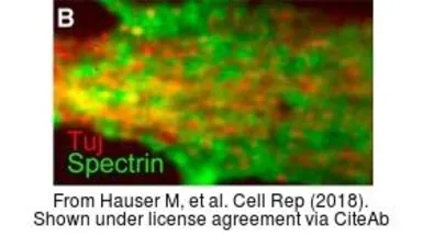 Anti-beta Tubulin 3/ Tuj1 antibody used in Immunocytochemistry/ Immunofluorescence (ICC/IF). GTX85469