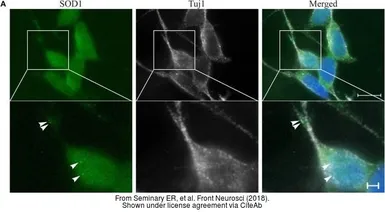 Anti-beta Tubulin 3/ Tuj1 antibody used in Immunocytochemistry/ Immunofluorescence (ICC/IF). GTX85469