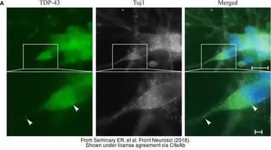 Anti-beta Tubulin 3/ Tuj1 antibody used in Immunocytochemistry/ Immunofluorescence (ICC/IF). GTX85469