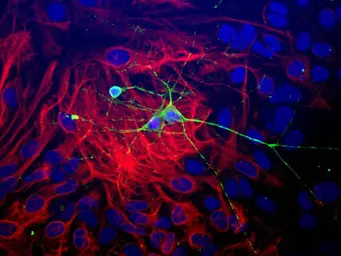 Anti-beta Tubulin 3/ Tuj1 antibody used in Immunocytochemistry/ Immunofluorescence (ICC/IF). GTX85469