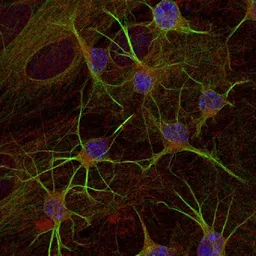 Anti-beta Tubulin 3/ Tuj1 antibody used in Immunocytochemistry/ Immunofluorescence (ICC/IF). GTX85469