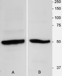 Anti-beta Tubulin 3/ Tuj1 antibody used in Western Blot (WB). GTX85469