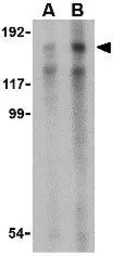 Anti-TRBP1 antibody used in Western Blot (WB). GTX85487